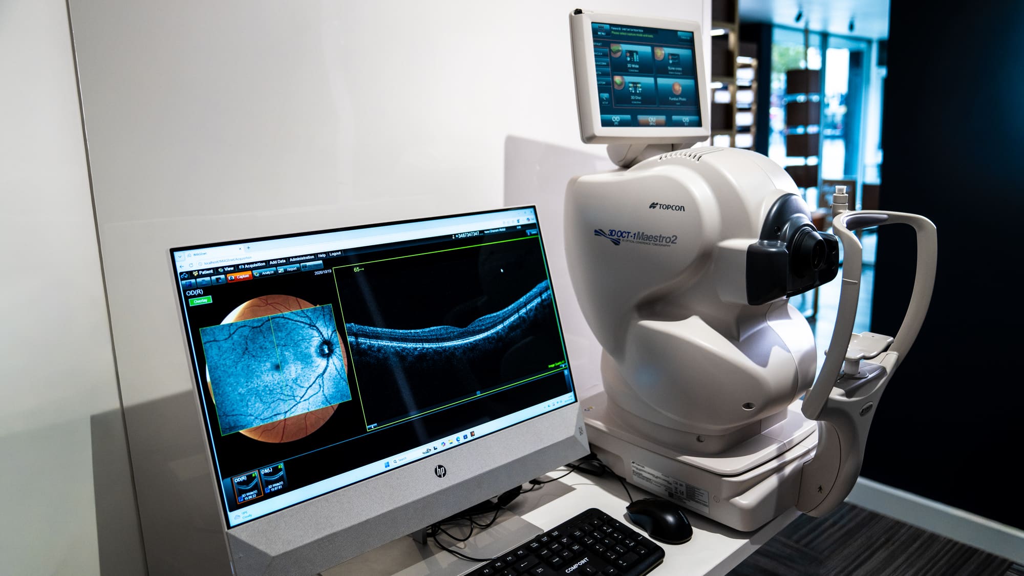 3D OCT retinal scan on screen beside the scanner